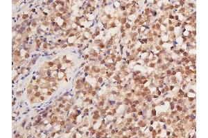 Immunohistochemistry (IHC) image for anti-Tumor Protein P53 (TP53) (pSer392) antibody (ABIN6256312)