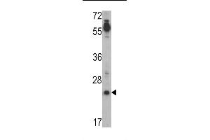 Western blot analysis of CRIPTO (TDGF1) Antibody (N-term) (ABIN388791 and ABIN2839123) in Jurkat cell line lysates (35 μg/lane). (TDGF1 antibody  (N-Term))