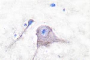 Image no. 2 for anti-Synaptosomal-Associated Protein, 25kDa (SNAP25) antibody (ABIN271818) (SNAP25 antibody)