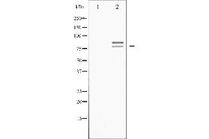 Western blot analysis of HSL phosphorylation expression in Adriamyci treated HeLa whole cell lysates,The lane on the left is treated with the antigen-specific peptide.