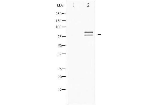 LIPE Antikörper  (pSer554, pSer855)