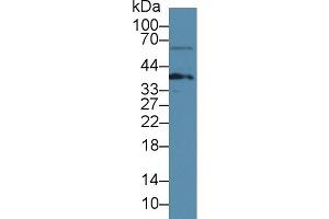 Western Blot; Sample: Rat Thymus lysate; ;Primary Ab: 3µg/ml Rabbit Anti-Mouse LAT Antibody;Second Ab: 0. (LAT antibody  (AA 30-237))