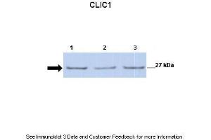 Lanes:   Lane 1: 30ug mouse renal epithelial lysate Lane 2: 30ug mouse renal epithelial lysate Lane 3: 30ug mouse renal epithelial lysate  Primary Antibody Dilution:   1:500  Secondary Antibody:   Anti-rabbit-HRP  Secondary Antibody Dilution:   1:2500  Gene Name:   CLIC1  Submitted by:   Dr. (CLIC1 antibody  (C-Term))