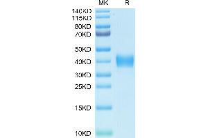 SARS-CoV Spike Protein (RBD) (His-Avi Tag,Biotin)