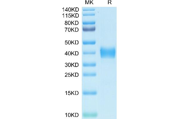 SARS-CoV Spike Protein (RBD) (His-Avi Tag,Biotin)