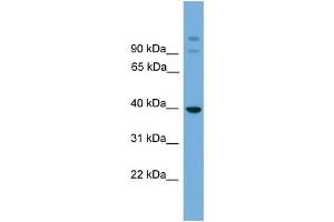 WB Suggested Anti-SUGT1 Antibody Titration: 0. (SUGT1 antibody  (Middle Region))