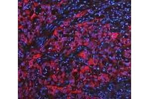 IF analysis of Cytokeratin 20/Krt20 using anti-Cytokeratin 20/Krt20 antibody (ABIN7601133). (KRT20 antibody  (AA 29-431))