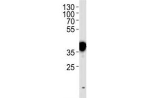 Western Blotting (WB) image for anti-Nucleophosmin (Nucleolar phosphoprotein B23, Numatrin) (NPM1) (AA 7-33) antibody (ABIN3032075)