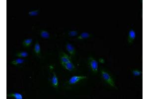 Immunofluorescent analysis of Hela cells using ABIN7159505 at dilution of 1:100 and Alexa Fluor 488-congugated AffiniPure Goat Anti-Rabbit IgG(H+L) (STEAP3 antibody  (AA 1-207))