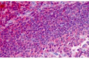 Human Tonsil: Formalin-Fixed, Paraffin-Embedded (FFPE) (HCLS1 antibody  (AA 266-356))