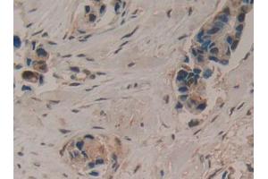 Used in DAB staining on fromalin fixed paraffin- embedded liver tissue (LIFR antibody  (AA 45-184))