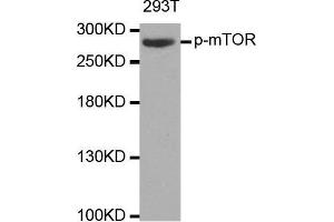 Western blot analysis of extracts of 293T cell line, using phospho-MTOR-S2448 antibody. (MTOR antibody  (pSer2448))