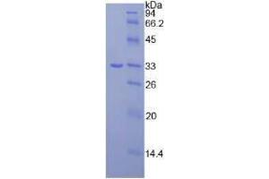 Image no. 1 for Janus Kinase 3 (JAK3) (AA 716-967) (Active) protein (His tag) (ABIN6239869) (JAK3 Protein (AA 716-967) (His tag))