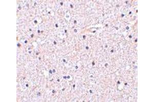 Immunohistochemistry of NCSTN in human brain tissue with NCSTN polyclonal antibody  at 5 ug/mL . (Nicastrin antibody  (C-Term))