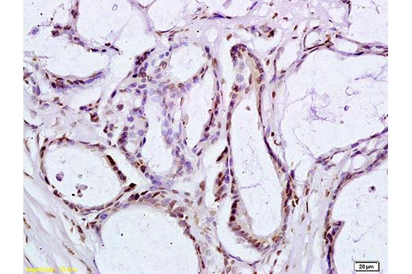 Protein Rta/BRLF1 antibody  (AA 81-180)
