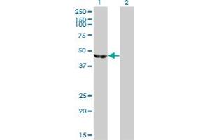 Western Blot analysis of ENO3 expression in transfected 293T cell line by ENO3 monoclonal antibody (M01), clone 5D1. (ENO3 antibody  (AA 228-277))