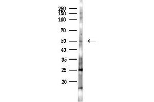 anti-DEK Oncogene (DEK) (Internal Region) antibody