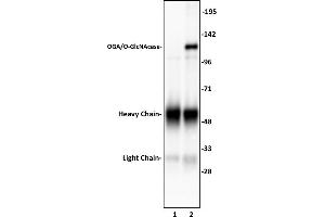 OGA/O-GlcNAcase antibody (pAb) tested by Immunoprecipitation. (MGEA5 antibody  (N-Term))