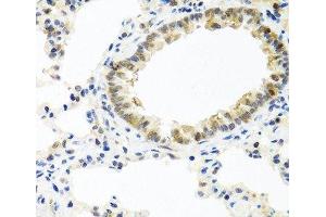 Immunohistochemistry of paraffin-embedded Rat lung using BMP5 Polyclonal Antibody at dilution of 1:100 (40x lens). (BMP5 antibody)