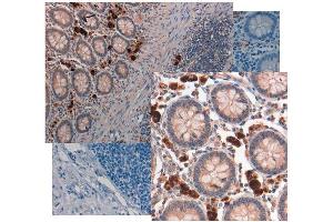 Immunohistochemistry (IHC) image for anti-Growth Differentiation Factor 15 (GDF15) (C-Term) antibody (Biotin) (ABIN1043920)