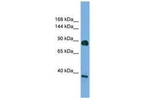 Image no. 1 for anti-Discs, Large Homolog 4 (Drosophila) (DLG4) (AA 683-732) antibody (ABIN6749749) (DLG4 antibody  (AA 683-732))