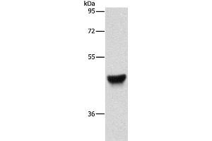 Western Blot analysis of Human esophagus cancer tissue using CK-13 Polyclonal Antibody at dilution of 1:500 (Cytokeratin 13 antibody)