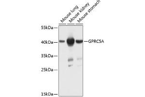 Western blot analysis of extracts of various cell lines, using GPRC5A antibody (ABIN6131897, ABIN6141357, ABIN6141358 and ABIN6224198) at 1:1000 dilution. (GPRC5A antibody  (AA 258-357))