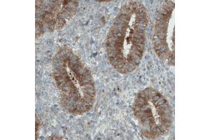 Immunohistochemical staining (Formalin-fixed paraffin-embedded sections) of human uterus with DIAPH2 monoclonal antibody, clone CL1111  shows strong cytoplasmic immunoreactivity in glandular cells. (DIAPH2 antibody)