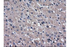 Immunohistochemical staining of paraffin-embedded liver tissue using anti-SLC2A5mouse monoclonal antibody. (SLC2A5 antibody)