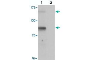 Western blot analysis of RUSC2 in SK-N-SH cell lysate with RUSC2 polyclonal antibody  at 1 ug/mL in (lane 1) the absence and (lane 2) the presence of blocking peptide. (RUSC2 antibody  (N-Term))