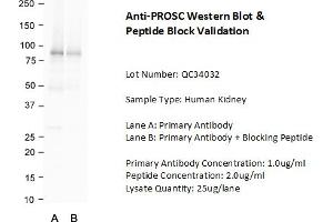 Host: Rabbit Target Name: PROSC Sample Type: Human Kidney  Lane A: Primary Antibody  Lane B: Primary Antibody + Blocking Peptide  Primary Antibody Concentration: 1.