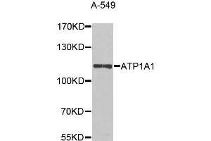 Western blot analysis of extracts of A-549 cells, using ATP1A1 antibody (ABIN5995394) at 1/1000 dilution. (ATP1A1 antibody)