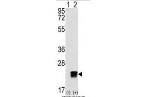 Western blot analysis of ARL3 (arrow) using rabbit polyclonal ARL3 Antibody (C-term) (ABIN389001 and ABIN2839231). (ARL3 antibody  (C-Term))