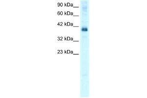 WB Suggested Anti-TSC22D4 Antibody Titration: 0. (TSC22D4 antibody  (N-Term))