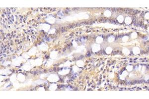 Detection of ST2 in Human Small intestine Tissue using Monoclonal Antibody to Syntenin 2 (ST2) (SDCBP2 antibody  (AA 1-292))