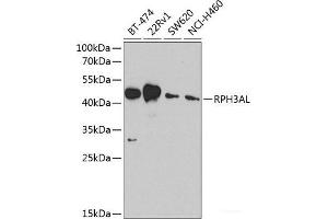 Western blot analysis of extracts of various cell lines using RPH3AL Polyclonal Antibody at dilution of 1:1000. (RPH3AL antibody)