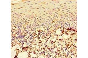 Immunohistochemistry of paraffin-embedded human tonsil tissue using ABIN7167196 at dilution of 1:100 (RAC1 antibody  (AA 11-185))