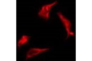 ABIN6277783 staining Hela by IF/ICC. (PERK antibody  (pThr982))