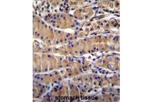 TEKT5 Antibody (Center) immunohistochemistry analysis in formalin fixed and paraffin embedded human stomach tissue followed by peroxidase conjugation of the secondary antibody and DAB staining. (TEKT5 antibody  (Middle Region))