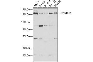 Western blot analysis of extracts of various cell lines, using DNMT3A antibody (ABIN6130285, ABIN6139748, ABIN6139750 and ABIN6222162) at 1:1000 dilution.