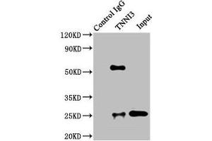 Immunoprecipitating TNNI3 in Rat heart tissue Lane 1: Rabbit control IgG instead of ABIN7173574 in Rat heart tissue. (TNNI3 antibody  (AA 2-210))