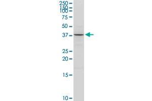 ACAT2 MaxPab rabbit polyclonal antibody. (ACAT2 antibody  (AA 1-397))