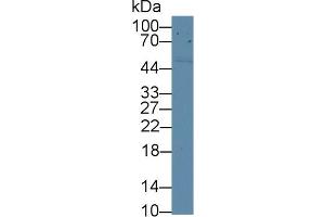 Detection of CD5 in Human HepG2 cell lysate using Polyclonal Antibody to Cluster Of Differentiation 5 (CD5) (CD5 antibody  (AA 25-372))