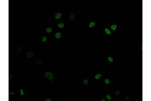 Immunofluorescence staining of HepG2 Cells with ABIN7127457 at 1:50, counter-stained with DAPI. (Recombinant DNMT1 antibody)