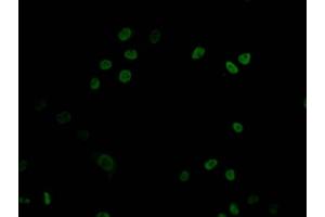 Immunofluorescence staining of HepG2 Cells with ABIN7127457 at 1:50, counter-stained with DAPI. (Recombinant DNMT1 antibody)
