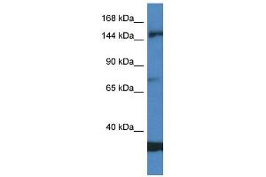 WB Suggested Anti-EIF5B AntibodyTitration: 1. (EIF5B antibody  (Middle Region))