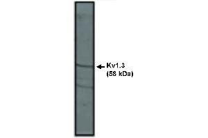 Western blot analysis using Kv1. (KCNA3 antibody)