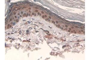Immunohistochemistry (IHC) image for anti-Interleukin 17 Receptor D (IL17RD) (AA 356-605) antibody (ABIN7443272)