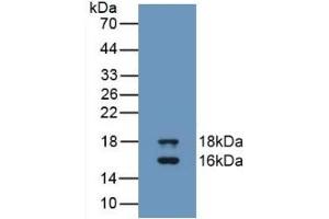 Detection of Recombinant GDF3, Human using Monoclonal Antibody to Growth Differentiation Factor 3 (GDF3) (GDF3 antibody  (AA 251-364))