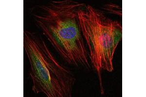 Immunofluorescence (IF) image for anti-Matrix Metallopeptidase 9 (Gelatinase B, 92kDa Gelatinase, 92kDa Type IV Collagenase) (MMP9) antibody (ABIN969288)